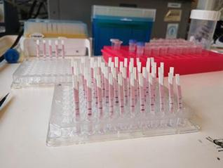 Rapd diagnostic test for COVID-19